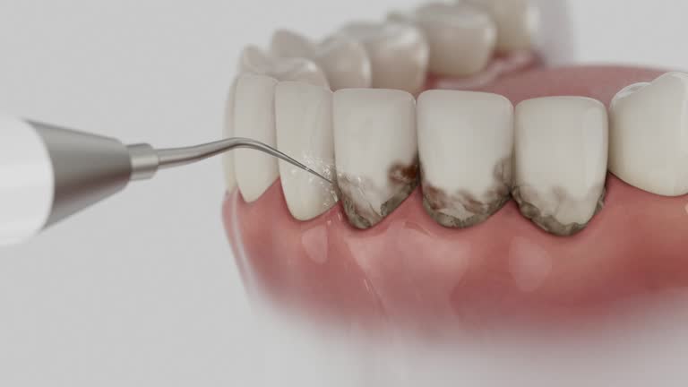 Reliable Dental Implants contractor in Evans, GA by Smile Center Dentistry